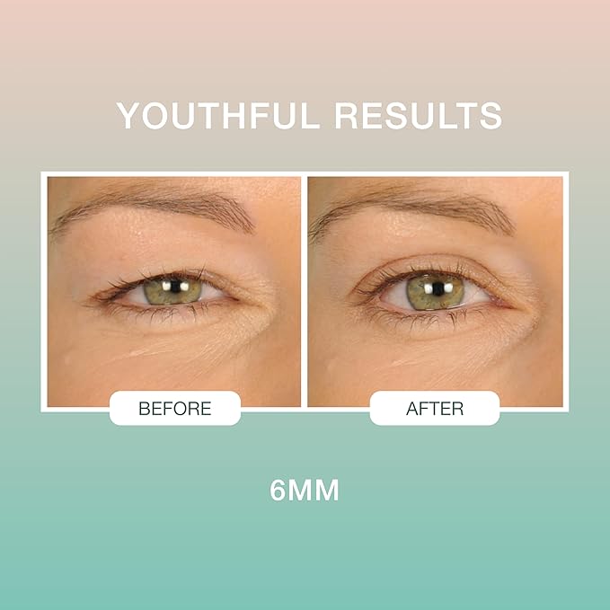 Contours Rx Lids by Design – 6mm Transparent Eyelid Lift Strips for Casual Mild to Moderate Hooded Lids – Medical-Grade, Anti-Aging Eyelid Tape – 80 Count