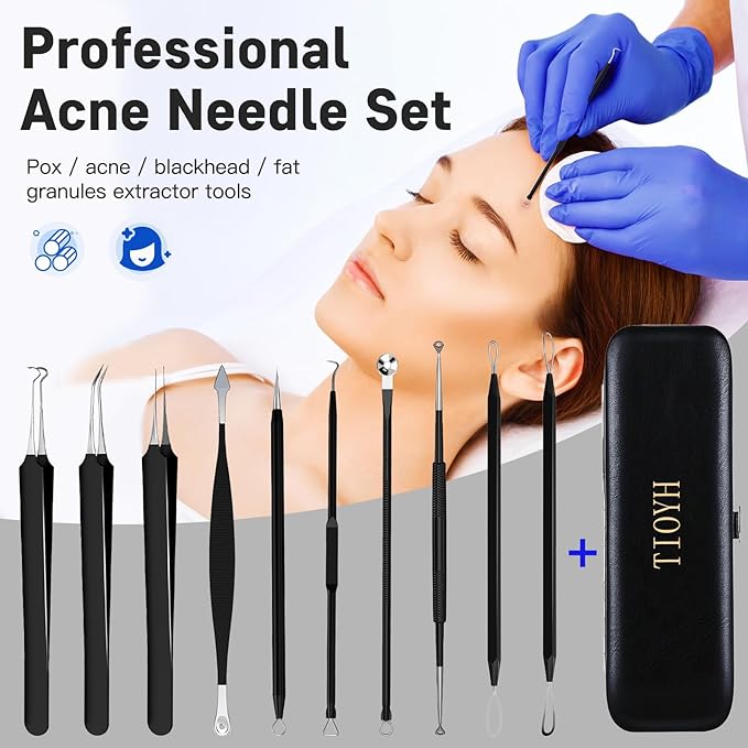Professional Pimple Popper Tool Kit,10 PCS Blackhead Remover Tweezers,Extractor Acne Removal Kit for Easy Removal for Pimples,Comedone Extractor Tools for Removing Zit,Acne Removal Kit (Black)