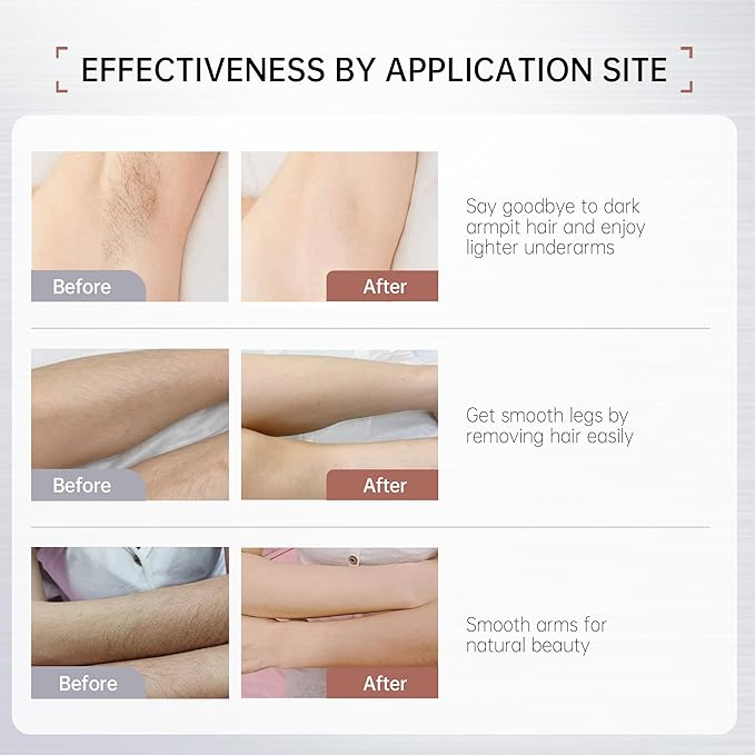 VGO Painless Bikini Gel for Women & Men, Unwanted Hair Removal for All Skin Types, 120ml / 4.06oz