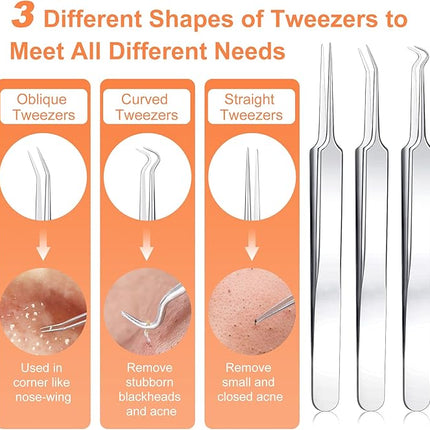 Pimple Popper Tool Kit, IUMAKEVP 15 PCS Professional Stainless Steel Blackhead Remover Comedone Extractor Tools for Removing Zit on Face - Acne Removal Kit with Metal Case (Silver)