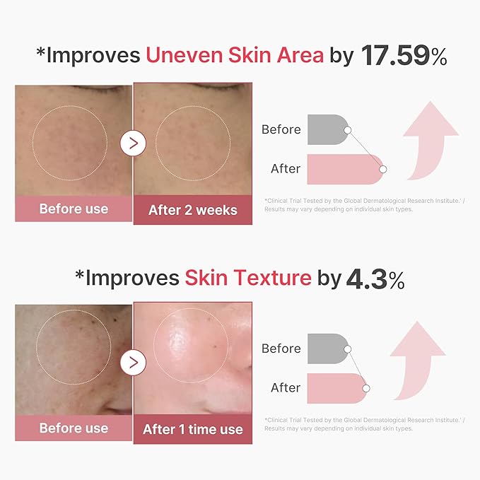 medicube PDRN Pink Collagen Exosome Shot Serum 2,000 PPM | Liquid Skin Booster | Exosome, Salmon DNA PDRN, Spicules | Uneven Skin Tone, Pore Care, Skin Texture | Korean Skin Care 1.01 fl.oz