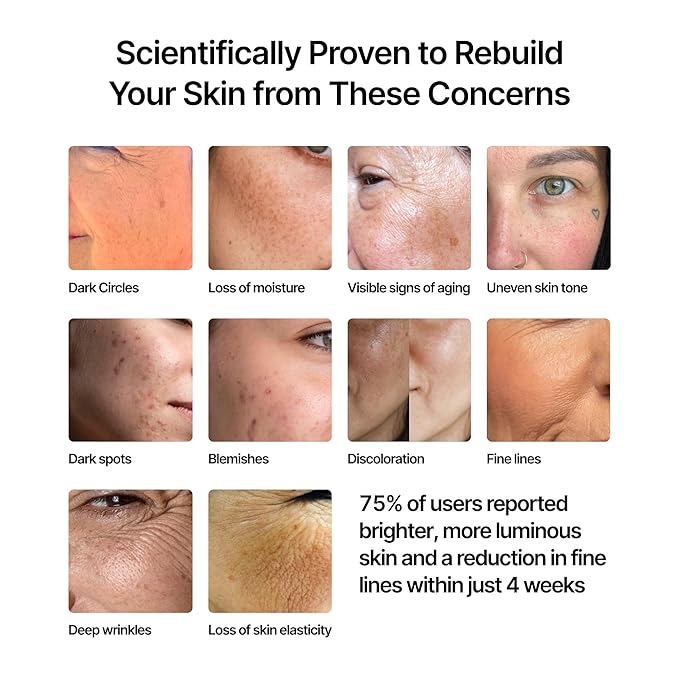 GENIX Beauty Face Cream - Anti-Aging, Anti-Wrinkle, Vitamin C & Firming Moisturizer, Clinically Proven Skincare to Hydrate, Repair, and Restore Skin. Fragrance-Free, for All Skin Types - 1 FL OZ