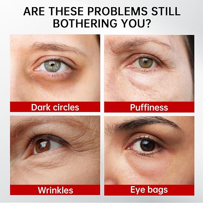 Retinol & Caffeine Eye Serum -360° Massage Roller for Puffiness,Eyebag Remover,Wrinkle Filler,Under Eye Cream For Dark Circles 0.54fl.oz (Pack of 2)