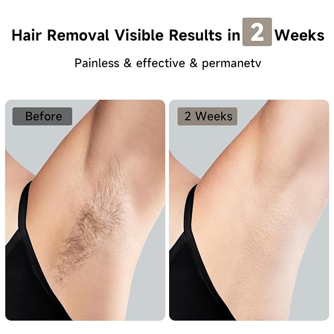 JOVS Laser Hair Removal, 37°F Painless Hair Removal Device with Sapphire Ice-Cooling, 3 in 1 Hair Removal & Skin Rejuvenation for Women and Men, 8 Modes Skin Care for Whole Body, Touch Screen