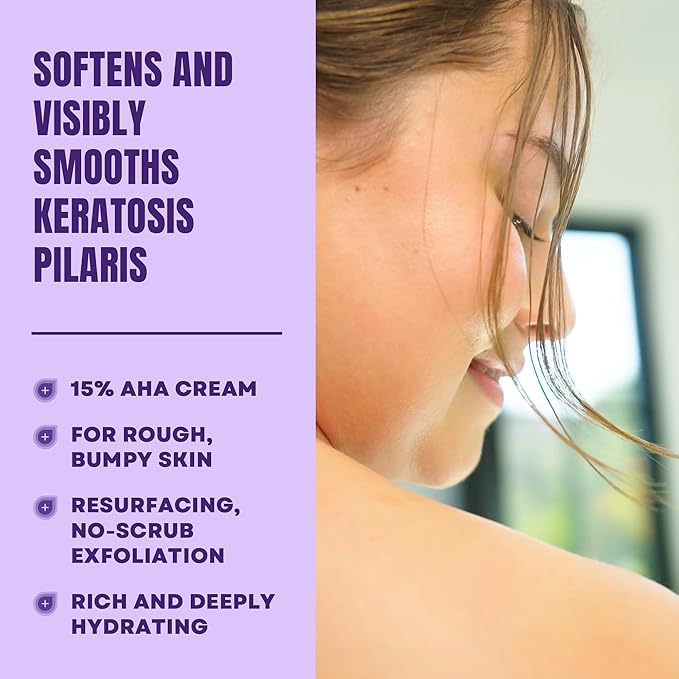 AmLactin KP Bumps Be Gone - 3 oz Keratosis Pilaris Moisturizing Cream with 15% Lactic Acid - Exfoliator and Moisturizer for Dry, Rough and Bumpy Skin (Packaging May Vary)