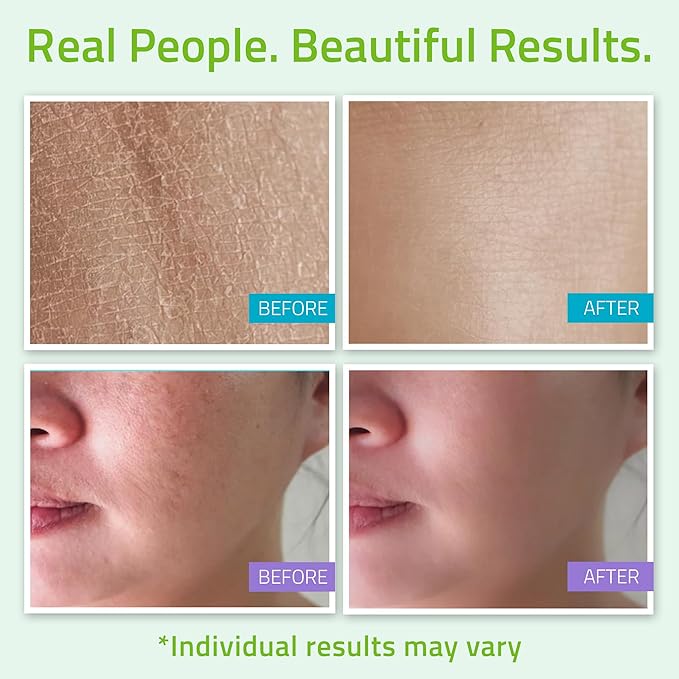 YEOUTH Skin Care Set: Hyaluronic Acid Serum, Vitamin C Cleanser, Toner & Face Cream, Teen Skincare Kit Girls & Boys 4-Piece Beauty Gifts