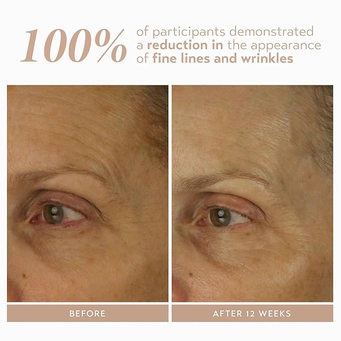 SHANI DARDEN SKIN CARE Retinol Reform with 1% Encapsulated Retinol Serum for Face & Neck, Gentle Slow-Release Retinol Face Serum with Tripeptide for Wrinkles, Fine Lines & Uneven Tone, 0.3 fl oz