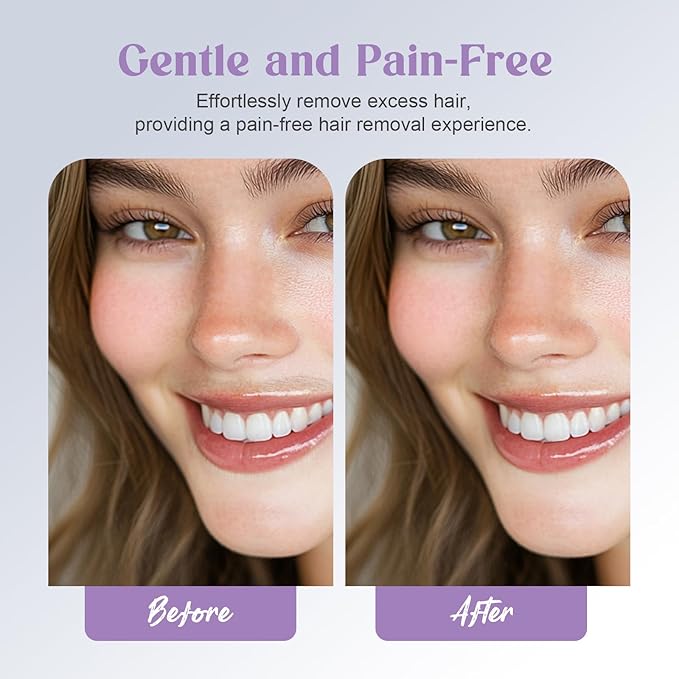 Battery Powered Facial Hair Remover for Women Lips, Chin, Neck, and Cheeks - Gentle and Pain with 2-pc Replacement Heads and 1 Battery