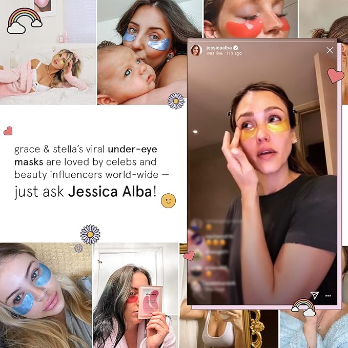 grace & stella Award Winning Under Eye Mask - Reduce Dark Circles, Puffy Eyes, Undereye Bags, Wrinkles - Gel Under Eye Patches - Gifts for Girlfriend - Vegan Cruelty-Free Self Care (48 Pairs, Pink)