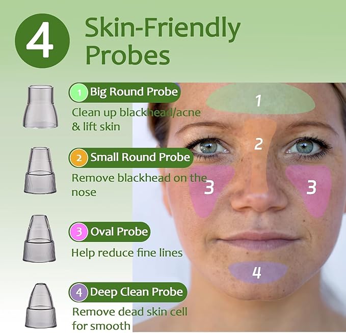 Blackhead Remover Pore Vacuum - Facial Pore Cleaner with 3 Adjustable Suction Levels, 4 Blackhead Removal Tools, Electric Acne Extractor Tool for Women & Men