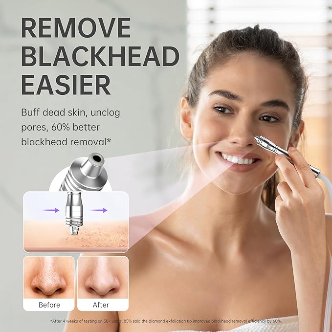 Blackhead Vacuum Removers, 2 in 1 Pro-Grade at-Home Spa Facial Vacuum Pore Cleaner for Blackheads, Whiteheads, Exfoliation, 20-80 Kpa Adjustable Suction for All Skin Types, White