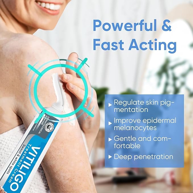 Vitiligo Cream, Natural Vitiligo Treatment Cream for Skin Vitiligo, Suitable for Skin Vitiligo, Leukoplakia, Suitable for Men and Women