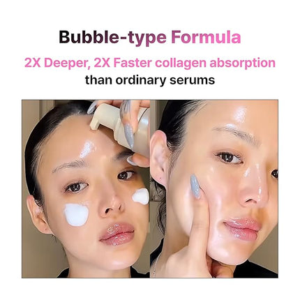 PO:DL Collagen Bubble Serum for Skin Elasticity Radiance Glow | Firming Hydrating Exfoliating Fast Absorbing Serum | K-Chestnut Collagen Niacinamide | No Fragrance 3.88 fl oz Korean Skincare
