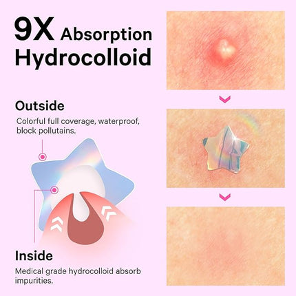 Sosky Hologram Pimple Patches for Face, Hydrocolloid Acne Patches with Salicylic Acid, Cute Star Zit Stickers,Colorful Blemish Covers,48 Count Pink Heart Flower