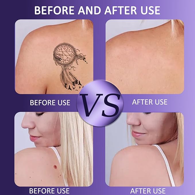 Leg Makeup Waterproof - Coverage for Scars & Blemishes, No Transfer, Lightweight & Long-Lasting, Natural Radiance (01)