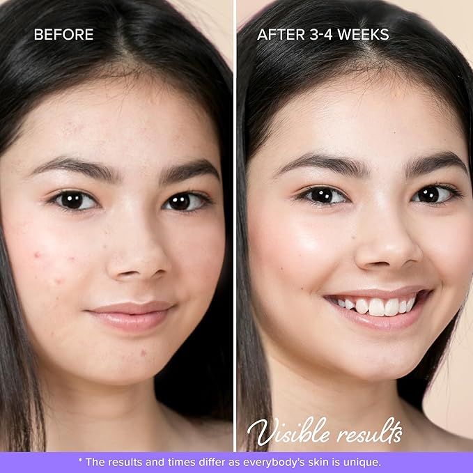 MAREE Star Pimple Patches for Face - Acne Patches - Natural Green Algae Extract & Tea Tree Oil - Hydrocolloid Stars Cute Zit Stickers, Parches Para Acne - 72 Marine Collagen Blemish Pimple Dots