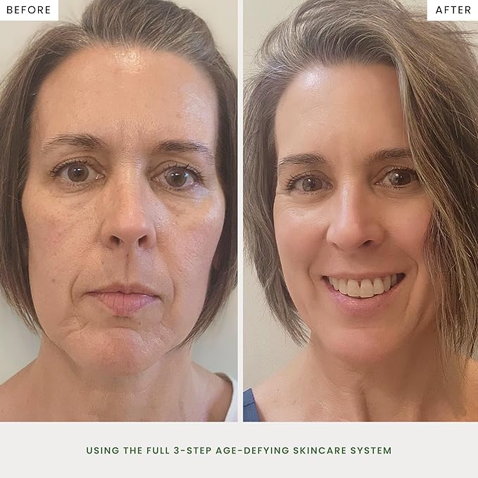 The Spa Dr. Skin Care - Antioxidant Serum - Anti Aging Skin Care - 30 Day Supply - Safe For All Skin Types - Perfectly pH Balanced - Organic Skin Care - Step 2 Nourish - 30 ML / 1 Fl. Oz.