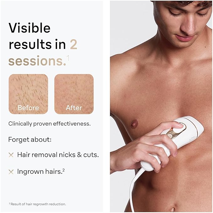 Braun Smart IPL, Silk·Expert Pro 5: at Home Laser Hair Removal Device for Men & Women, Permanent Visible Hair Reduction in Hair Regrowth for Body, w/Razor, Pouch, and Wide Cap Head, IPL5145