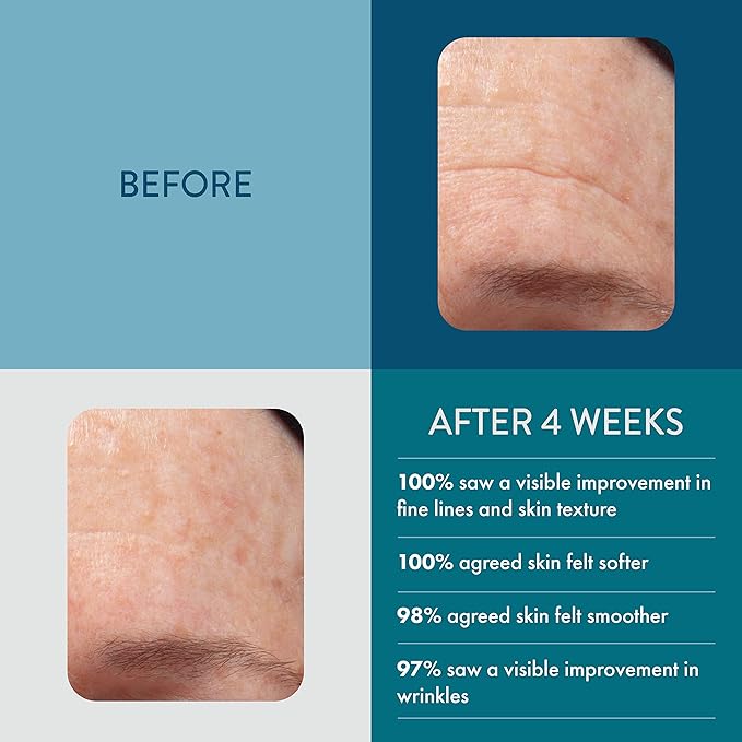 Lancer Skincare The Method: Nourish,Skincare for Face, Facial Moisturizer for Normal or Combination Skin, Bonus Size (3.4 oz)