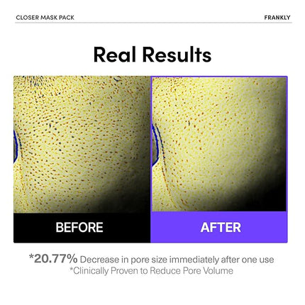 FRANKLY Closer Pore Minimizing Mask – Semi-Gel Face Sheet Mask for Pore Care & Firming | Non-sticky, Lightweight | Korean Skin Care with Collagen, Hyaluronic Acids & Peptides | 0.74 fl oz, 1pc