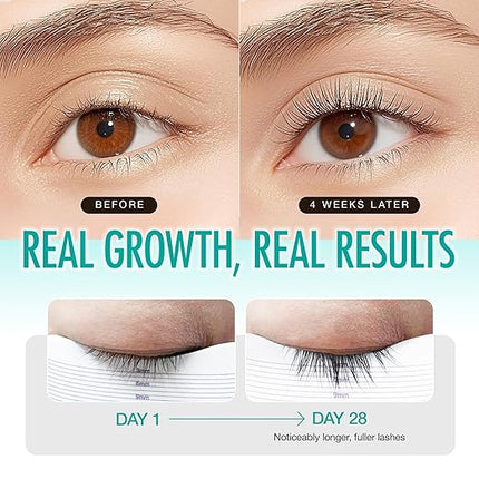 LASHVIEW Eyelash Growth Serum (0.17fl.oz / 5ml) - Premium Lash Enhancer for Longer, Thicker, Fuller Lashes - Strengthens & Conditions Lashes - Safe & Effective Formula for Visible Results in 2 Weeks