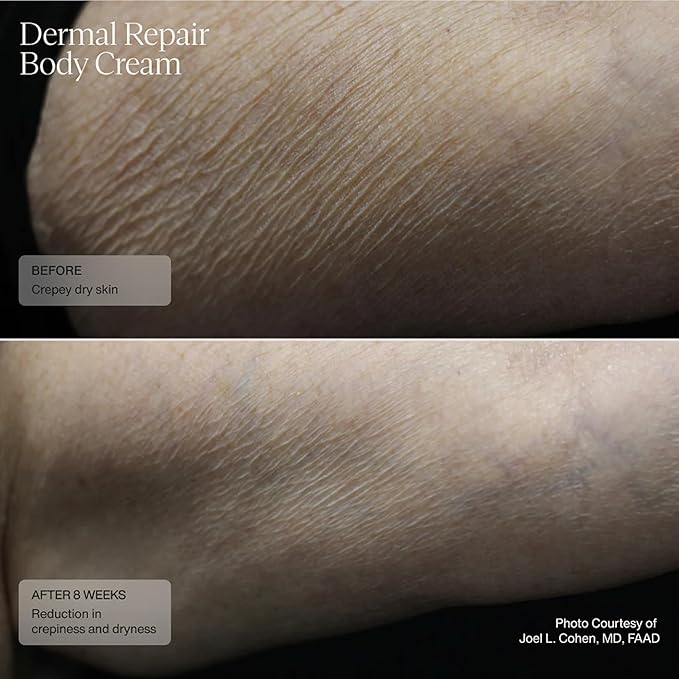 Senté Dermal Repair Body Cream | Restore Skin's Barrier | Soothes Sensitive Skin | Promotes New Collagen Production for Firmer Skin | 6 Fl Oz