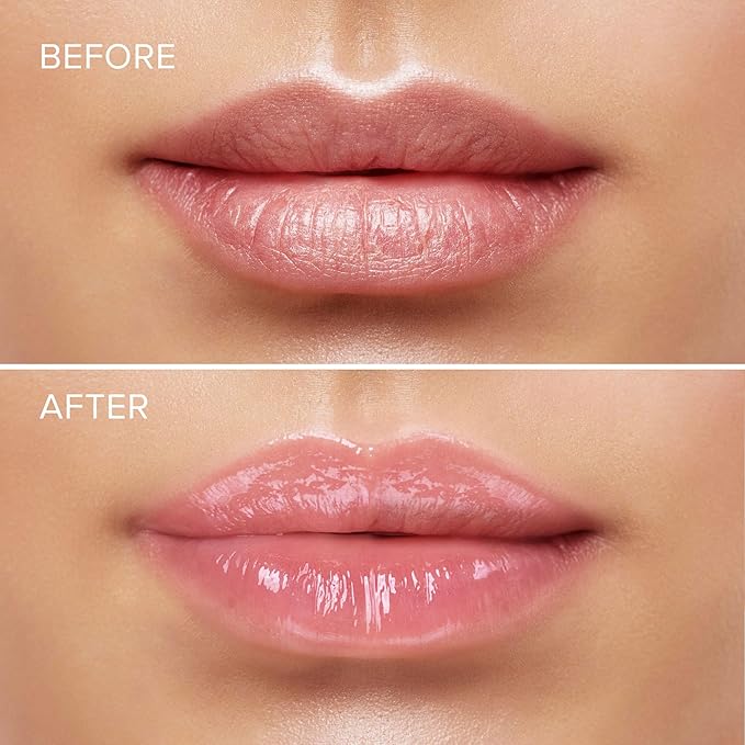 MAREE Lip Moisturizer - Lip Mask Overnight 2 Pack - Moisturizing Lips Butter Balm with Hyaluronic Acid - Lip Sleeping Mask - Lip Moisturizer For Very Dry Lips Care - Hidratante de Labios Care Products