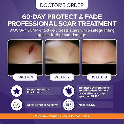 Advanced Scar Treatment with Silishield® & SPF 30 20g – Silicone Scar Gel for Surgical Scars & Keloids – Scar Cream for Old or New Scars – Surgeon Recommended – Safe for Adults & Kids – Made in USA