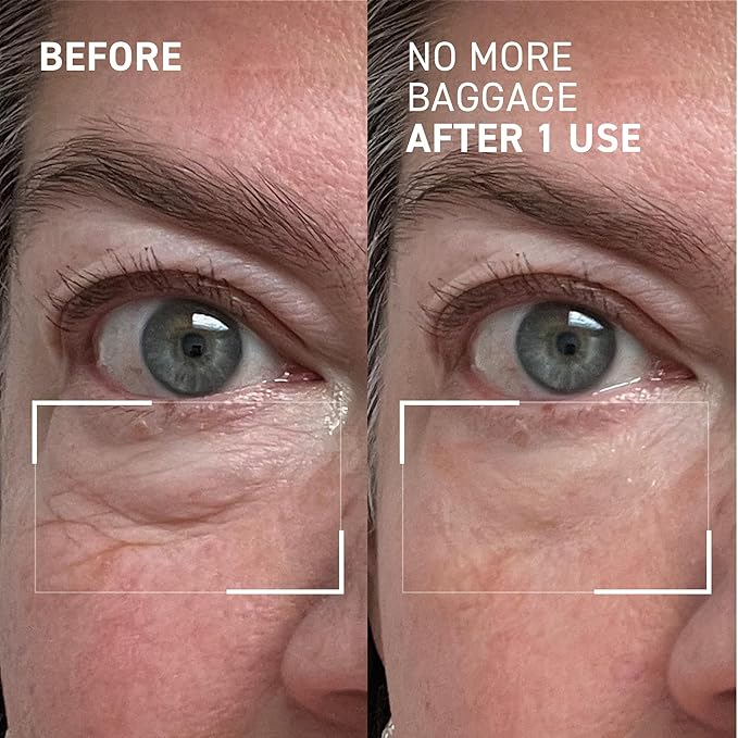 Dr. Brandt Needles No More, No More Baggage - Minimizes Under-Eye Bags, Puffiness & Dark Circles - 0.23 oz