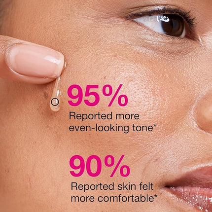 ISOI Blemish Care Up Serum for Face, Vegan Hydrating Serum for Smooth & Glass Skin Effect, Skin Barrier & Moisture Balance for Women, Arbutin & Rose Otto Oil, Korean Skin Care (0.85 fl. oz, 25ml)