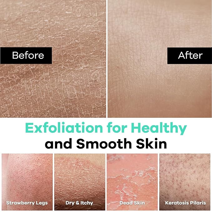 Dermasuri Deep Exfoliating Glove - Korean Exfoliating Mitt - Reusable Body Scrubber for Shower - Buffs Dry & Dead Ski - Keratosis Pilaris Treatment Scrub - Stocking Stuffer Gifts for Women & Men - XL