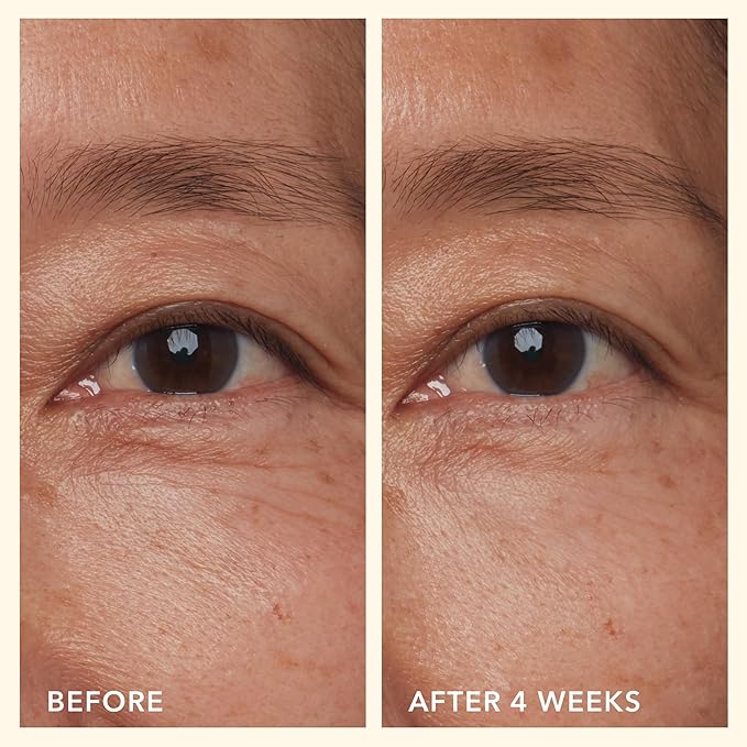 Beekman 1802 Mushroom Goat Milk Eye Cream - Clinically Proven Anti-Aging Eye Treatment for Dark Circles & Fine Lines - With Kojic Acid, Hexapeptide & Mushrooms - Fragrance-Free, Cruelty-Free