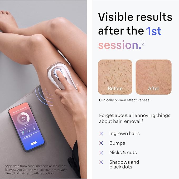 Braun Smart IPL, Skin i·Expert Pro 7: at Home Laser Hair Removal, Permanent Visible Hair Reduction, Holiday Gifts for Women and Men with Free App, Vanity Case, Venus Razor, 4 Smart Heads, IPL7387
