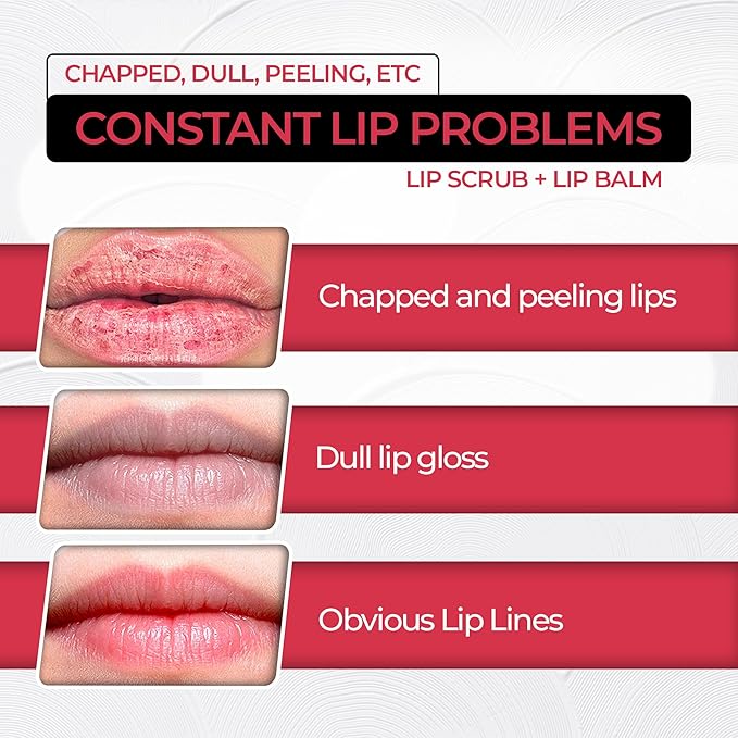 2 in 1 Lip Care Kit with Apple Lip Scrub Exfoliator 28g and Peach Balm Moisturizer 20g – Intense Hydration Set for Dry, Chapped, Cracked Lips (48g)