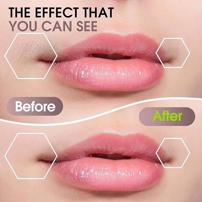 Facial Hair Removal for Women: Electric Hair Removal Device - Rechargeable Painless Face Razor for Chin Upper Lip Peach Fuzz with Light (Rose Gold)