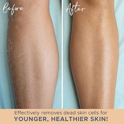 Exfoliating Glove (4 pcs, 2 Pairs) - Medium Shower Gloves for Body Scrub, Exfoliates & Removes Dead Skin