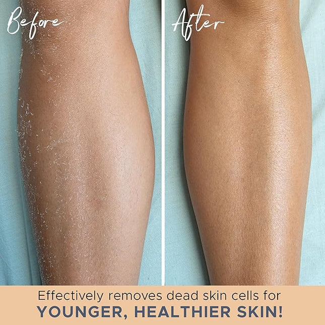 Exfoliating Glove (4 pcs, 2 Pairs) - Medium Shower Gloves for Body Scrub, Exfoliates & Removes Dead Skin